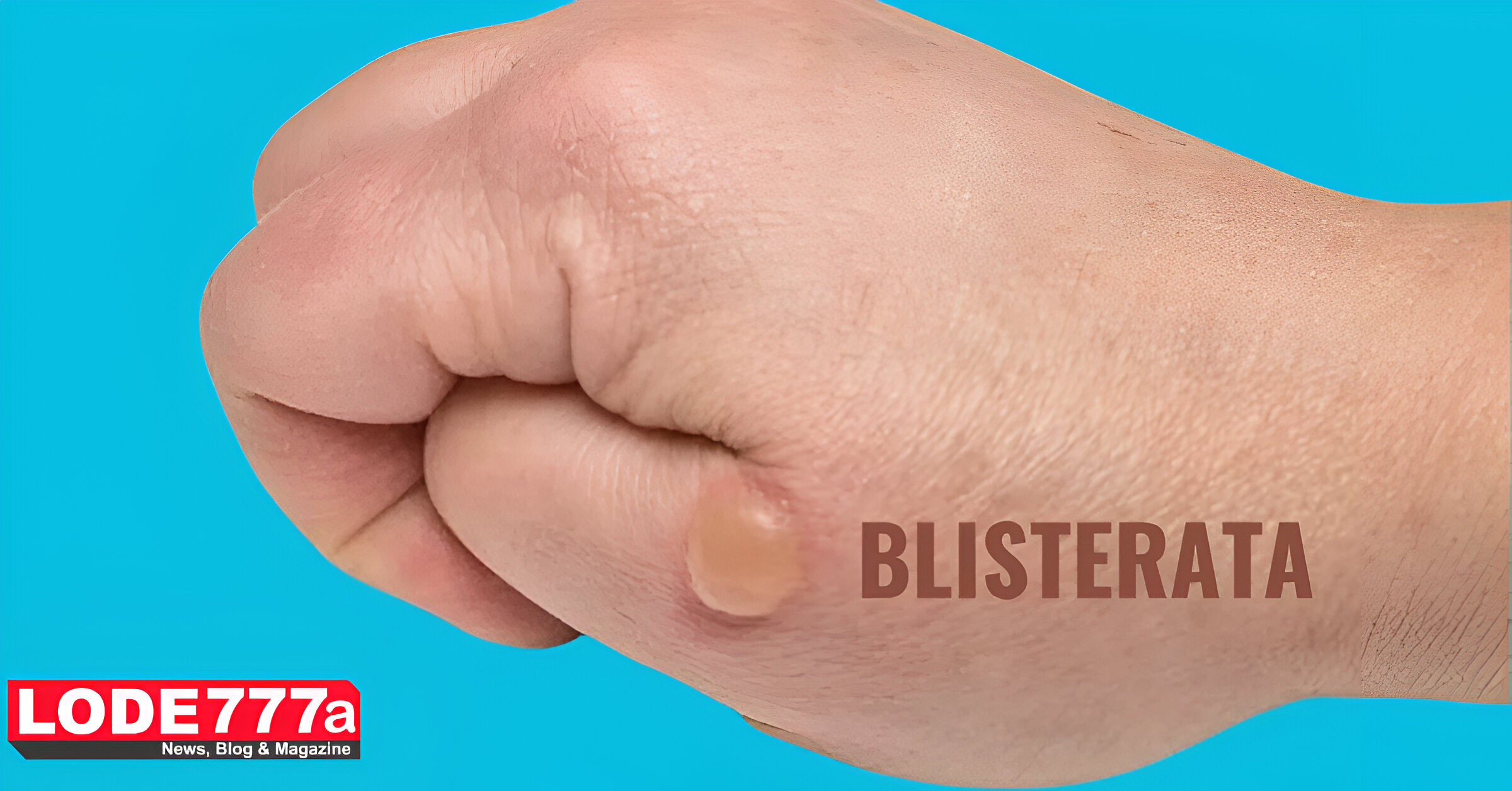 blisterata